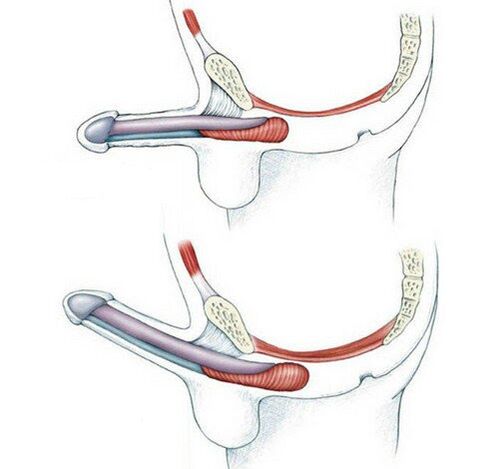 Penis without training the Puboccygeus muscle and after