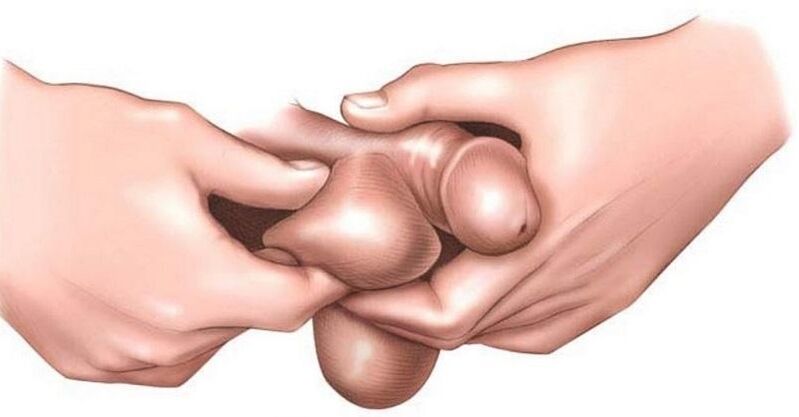 Why are the eggs itchy in men